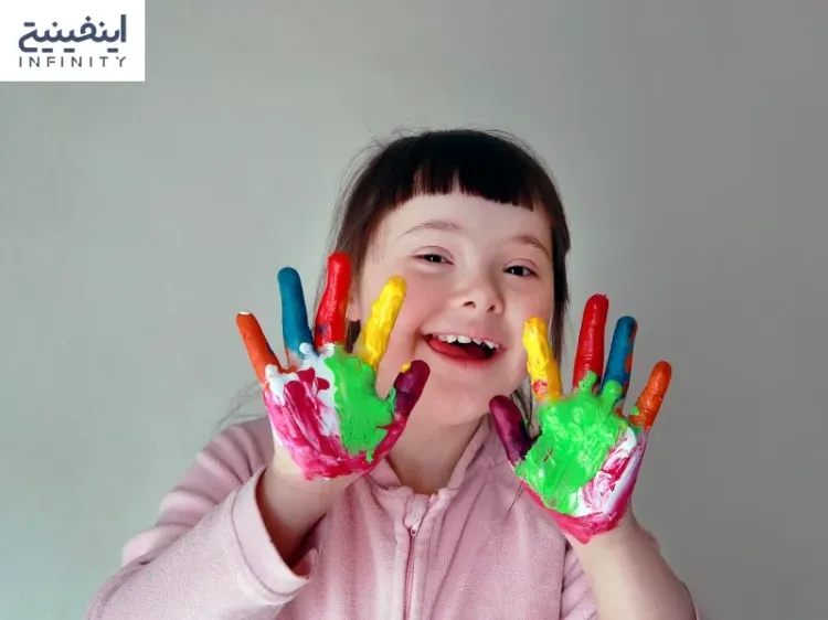 سندرم داون چیست; علائم و علل ایجاد سندروم داون